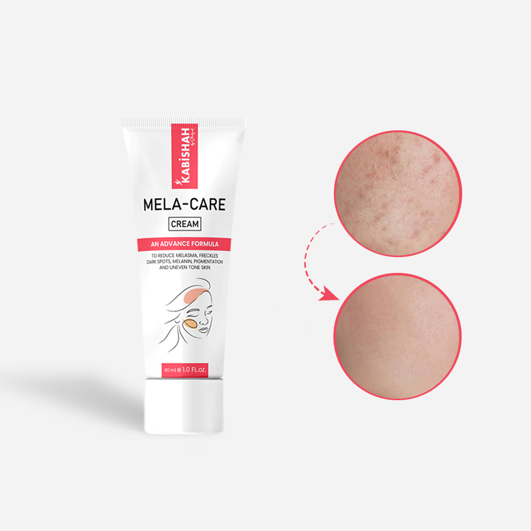 Mela Care Advanced Brightening Cream Double Pack Bundle